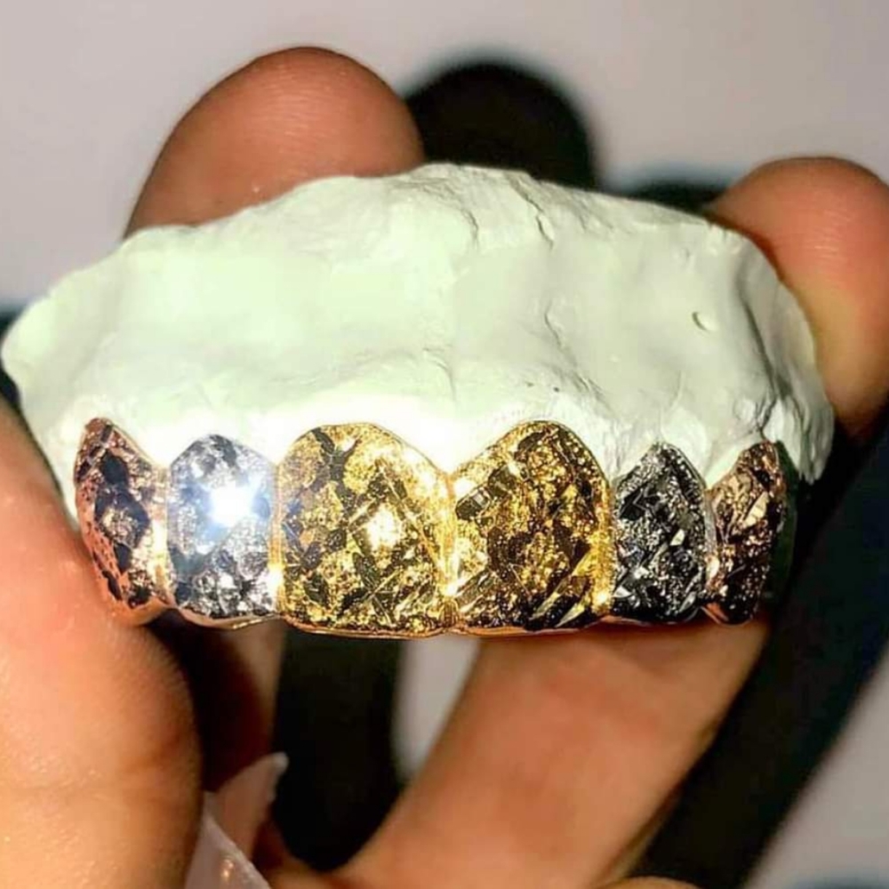 Custom gold grillz